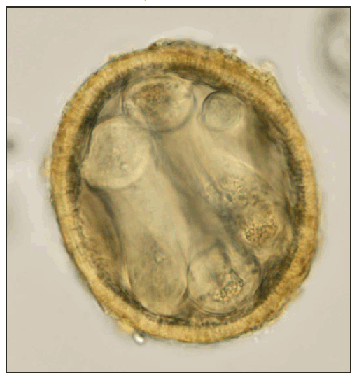 Baylisascaris