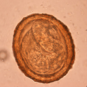 Baylisascaris
