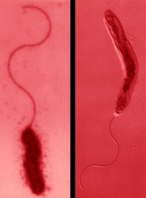 Campylobacter