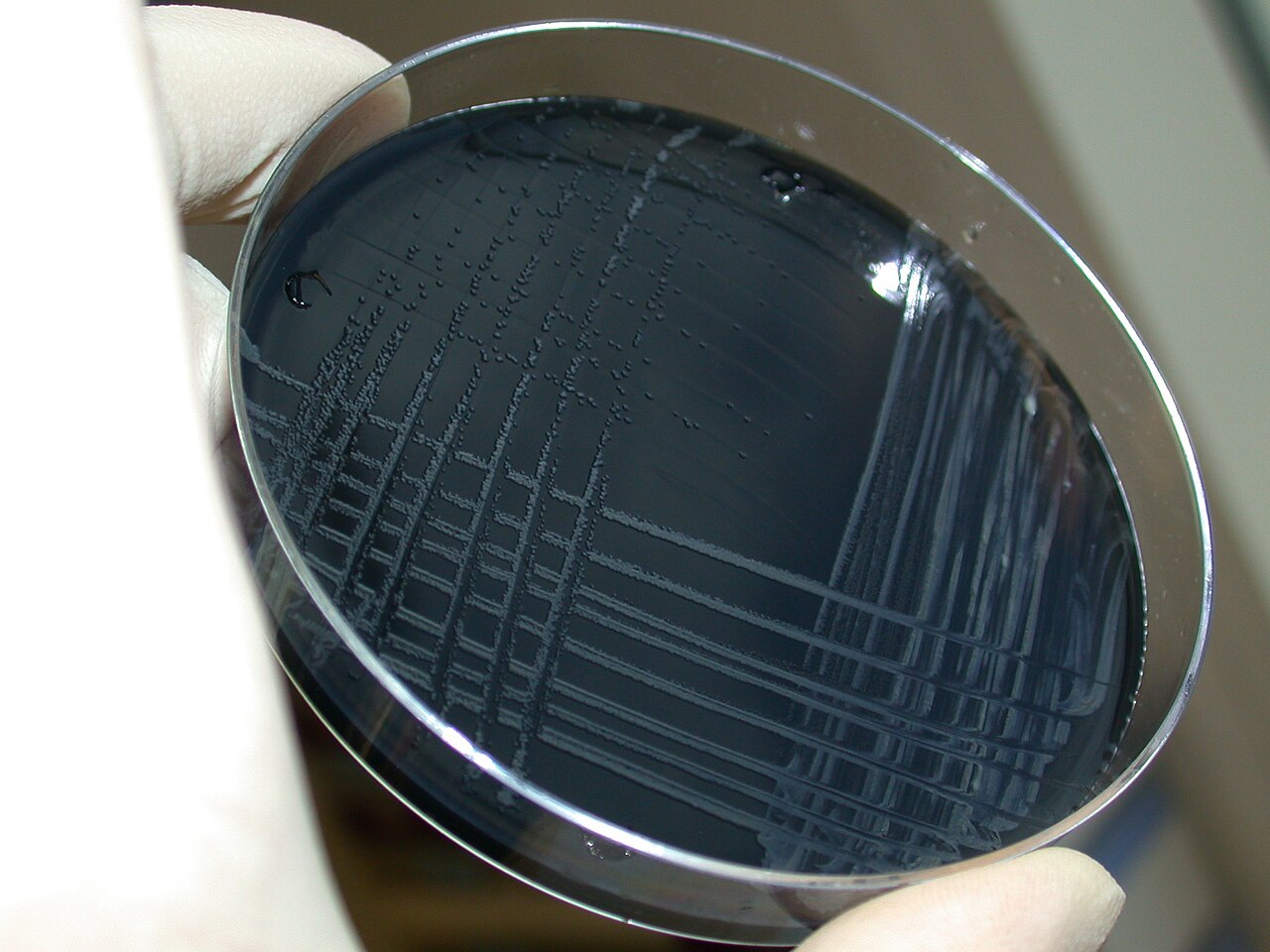Campylobacter