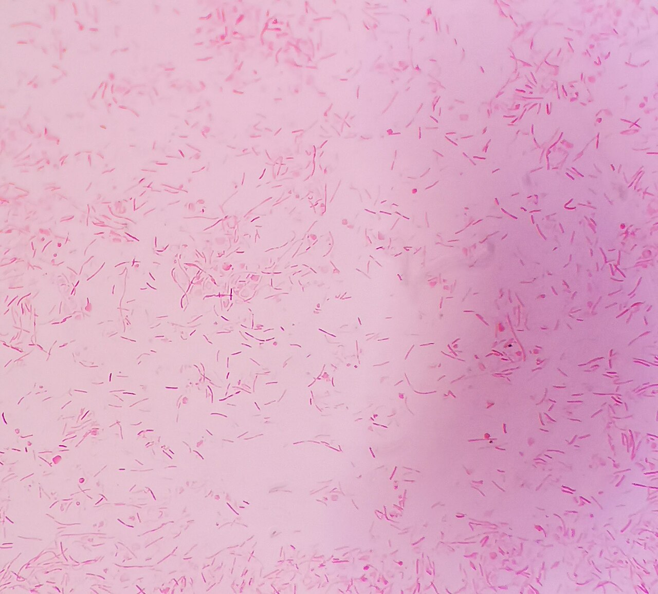 Capnocytophaga canimorsus