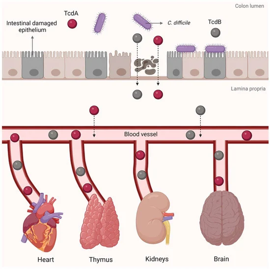Clostridioides difficile infection