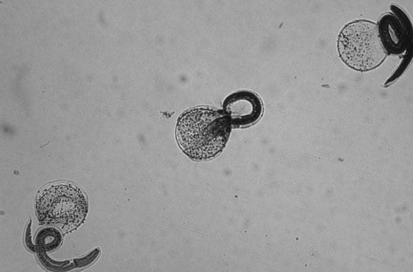 Baylisascaris larvae